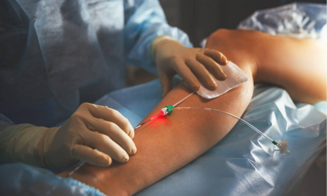 Κιρσοί: Μην βάζετε φρένο στη ζωή σας, θεραπεύστε τους οριστικά