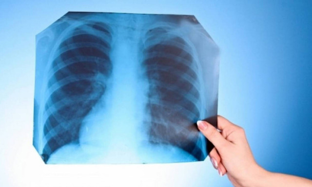 Χαλκίδα: Πήγε στο νοσοκομείο με φρικτούς πόνους - Έπαθε σοκ όταν είδε την ακτινογραφία (pics)