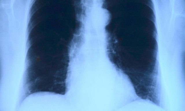 Έπαθαν ΣΟΚ οι γιατροί όταν είδαν την ακτινογραφία του (pics)