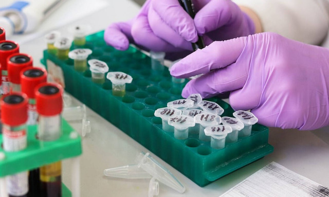 Novartis: Έγκριση από την Κομισιόν για χορήγηση ομαλιζουμάμπης στο σπίτι