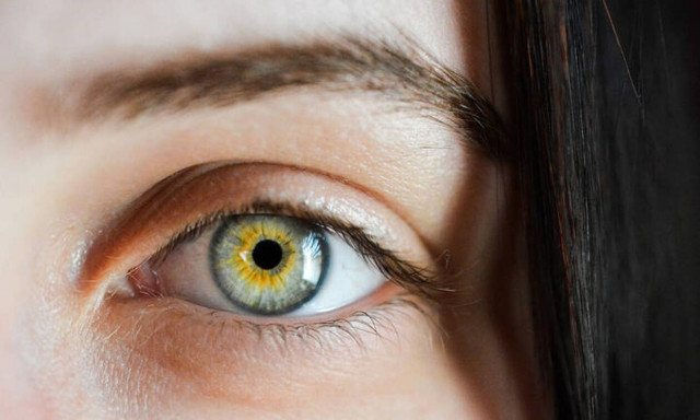 Πρωτοφανές ιατρικό περιστατικό: Μέλισσες ζούσαν μέσα στο μάτι 20χρονης!