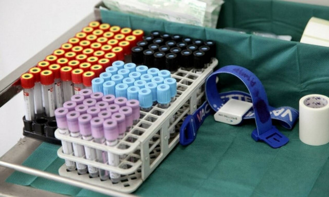 Έκτακτη σύσκεψη στον Πανελλήνιο Ιατρικό Σύλλογο – Το πρόβλημα με τις δωρεάν εξετάσεις 