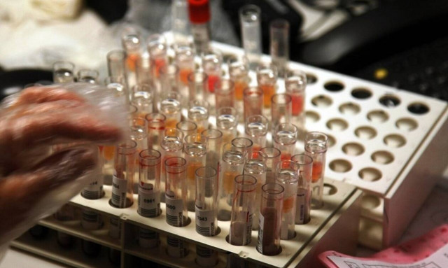 ΕΟΠΥΥ: Παράταση στα παραπεμπτικά διαγνωστικών εξετάσεων 