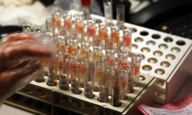 Διαγνωστικά κέντρα: Αδιέξοδο στην πρώτη συνάντηση με τον ΕΟΠΥΥ