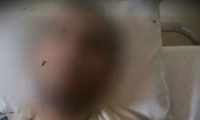 Συγκλονίζει ο 19χρονος που μαχαίρωσαν στην Καλλιθέα: «Η καρδιά μου είχε μια τεράστια τρύπα» (vid)