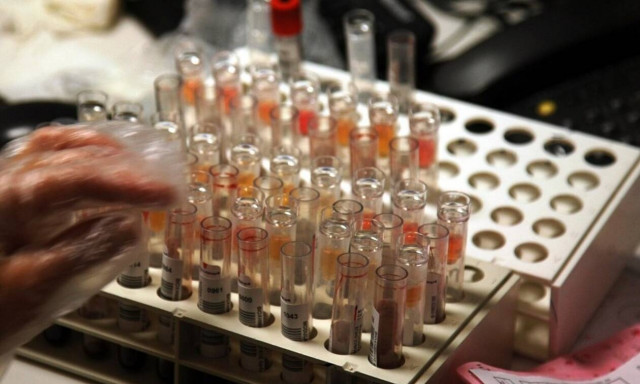 Διαγνωστικά κέντρα: Αναστολή των κινητοποιήσεων 