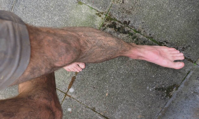 Ο πόνος στο πόδι δεν ήταν αθώος: «Πάγωσαν» οι γιατροί όταν ανακάλυψαν τι ήταν (pics)