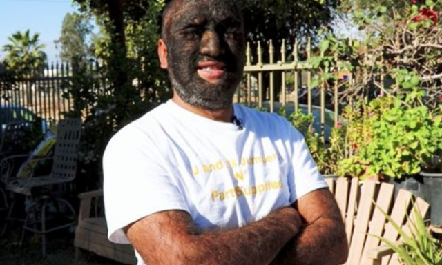 Δείτε τον μοναδικό πραγματικό «λυκάνθρωπο» του πλανήτη!