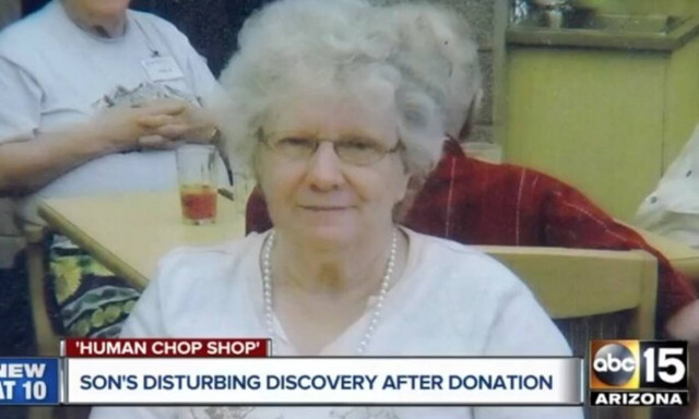 Φρίκη: Αποκαλύψεις - σοκ για το εργαστήριο του «Φρανκενστάιν» - Τι έκαναν σε 73χρονη