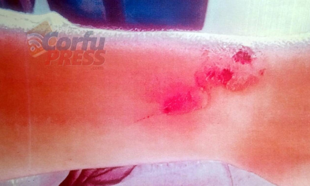 Τι απαντά ο πασίγνωστος σεφ στις καταγγελίες περί βασανισμού στο εστιατόριό του