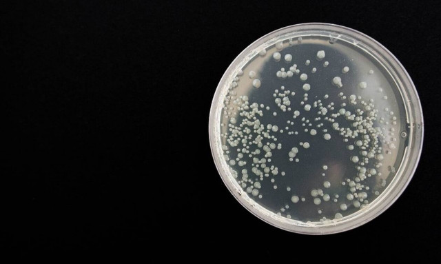 Συναγερμός στην Ιταλία για το «σούπερ βακτήριο» - 31 «ύποπτοι θάνατοι» στην Τοσκάνη (vid)