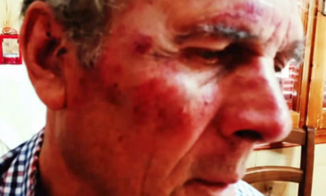 Θρίλερ στη Σάμο: Τούρκοι ξυλοκόπησαν ηλικιωμένο Έλληνα επειδή άκουγε εκκλησιαστικούς ύμνους