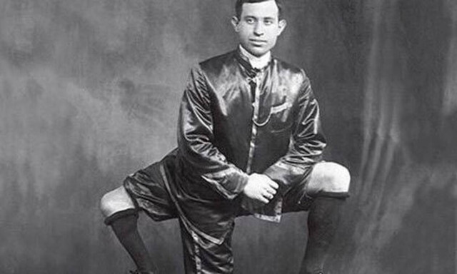 Σαν σήμερα το 1966 πεθαίνει ο Φραντζέσκο Λεντίνι, ο άνδρας με τα 3 πόδια και τα 2 γεννητικά όργανα 