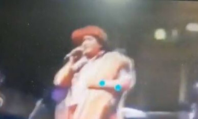 Σοκαριστικό ατύχημα επί σκηνής - Στο νοσοκομείο ο τραγουδιστής (vid)