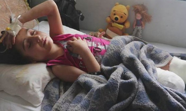 Συρία: Η συγκλονιστική ιστορία της 8χρονης που ακρωτηριάστηκε και έγινε το πρόσωπο του πολέμου