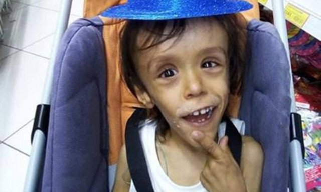 Ο «Μικρός Πρίγκιπας» ζητά στήριξη για τον μικρό Γιώργο για να υποβληθεί σε επέμβαση στην Αυστρία 