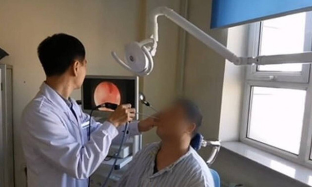 Πήγε στο νοσοκομείο με πόνους στη μύτη - «Πάγωσαν» οι γιατροί όταν είδαν τι είχε μέσα (pics+vid)