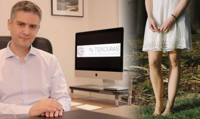 Κιρσοί: Μύθοι και αλήθειες που πρέπει να γνωρίζετε 