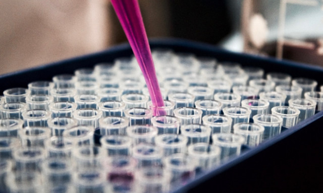 Ανοσοθεραπεία, χημειοθεραπεία ή συνδυασμός στον καρκίνο της κύστεως;