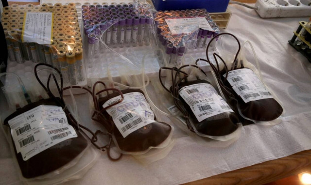 Η Ελλάδα αποκτά Σταθερές Αίθουσες Αιμοληψίας: Η εθελοντική αιμοδοσία αποδεσμεύεται από το νοσοκομείο