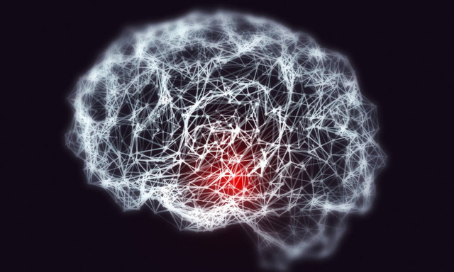 Εγκεφαλικό: Οι 7 παράγοντες που μειώνουν τον κίνδυνο κατά 60! (εικόνες)