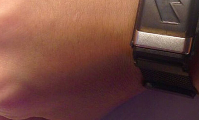 Αυτή η συσκευή σε βοηθά να αδυνατίσεις!