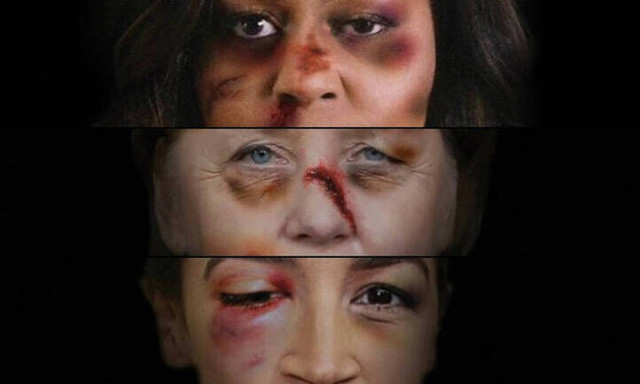 Πρησμένα πρόσωπα και μώλωπες: Πορτρέτα ισχυρών γυναίκων γίνονται «γροθιά» ενάντια στη βία