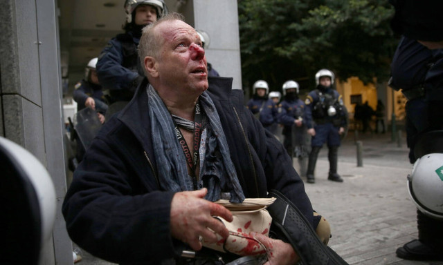 Deutsche Welle photographer hit by unknown persons while covering rally