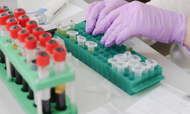 ΕΟΔΥ: Σε επιφυλακή και στην Ελλάδα για τον κοροναϊό