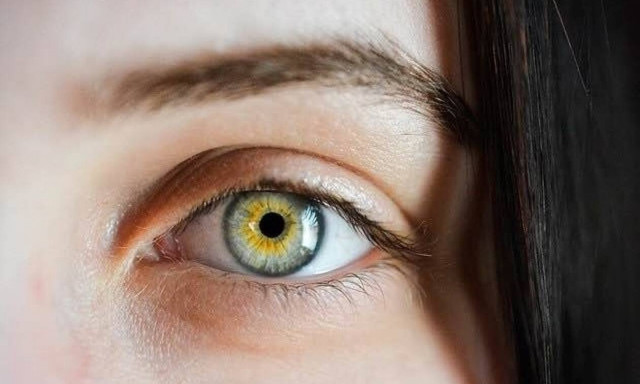 Δες φωτογραφίες όταν η Χαλκίδα ήταν ένα μεγάλο χωριό!