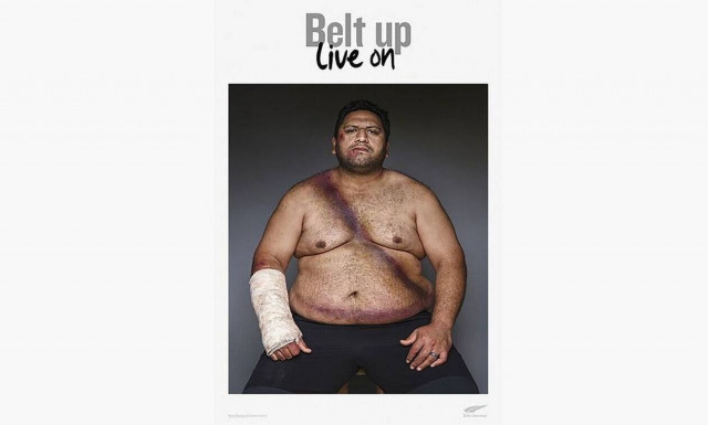 Οι ζώνες ασφαλείας άφησαν τα σημάδια τους όμως τους έσωσαν τη ζωή!