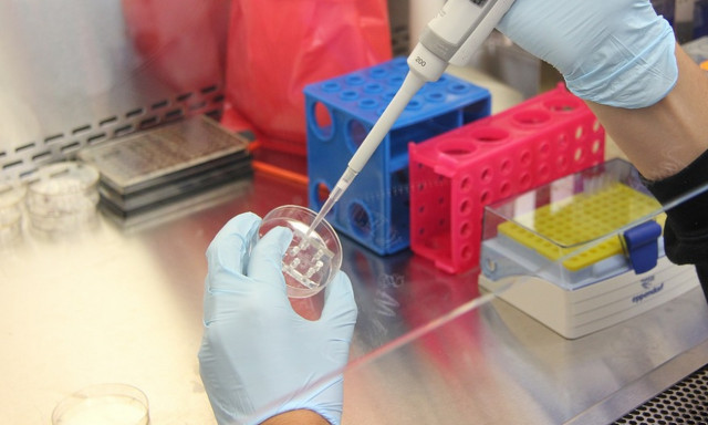 Τρόμος: Εμφανίστηκε νέος μυστηριώδης ιός - Δείτε πού