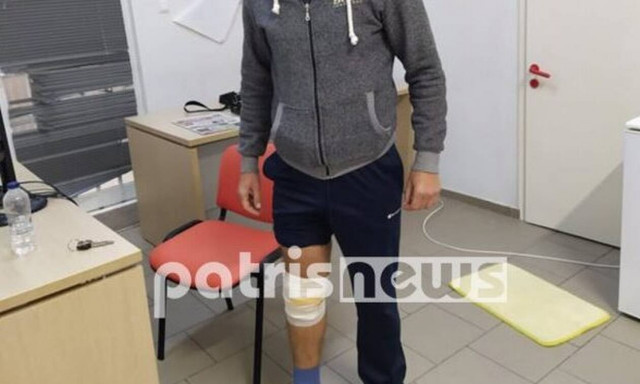 Φρίκη στην Αμαλιάδα: Άγρια επίθεση σκύλου σε πατέρα και κόρη