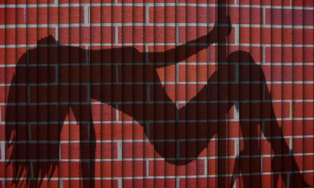 Σοκαριστικό ατύχημα: Στρίπερ έπεσε και έσπασε το σαγόνι της αλλά συνέχισε να χορεύει (videos)