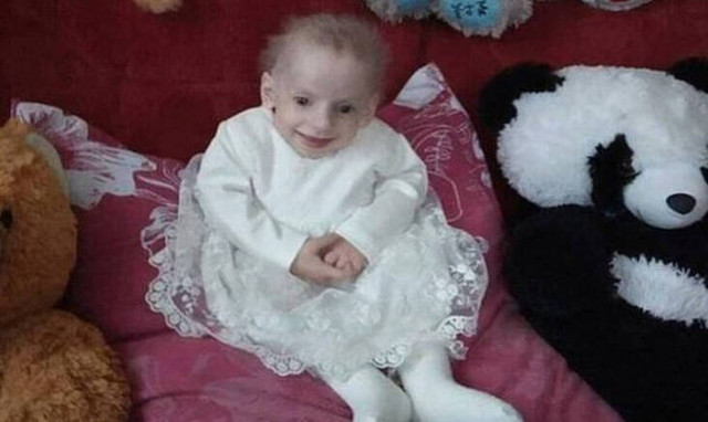 Σοκ: Πέθανε 8χρονο από γηρατειά