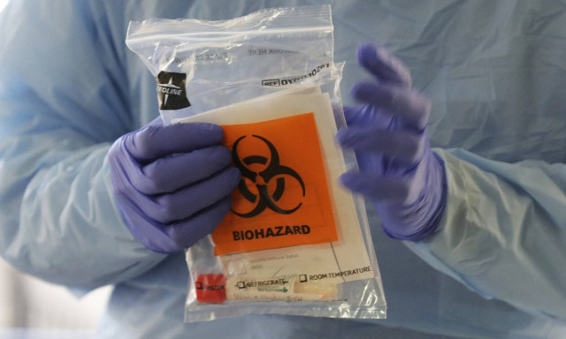 Κορονοϊός: Μόνο σε αυτούς θα γίνεται πλέον το τεστ στα ελληνικά δημόσια νοσοκομεία