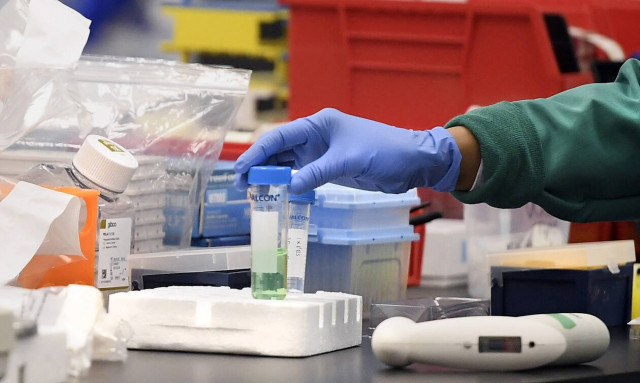 Κορονοϊός: Νέα επιστημονική έρευνα - Υπάρχουν ομάδες αίματος πιο ευάλωτες στον ιό;