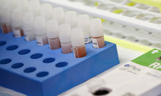 Κορονοϊός: Ενθαρρυντικά μηνύματα για το φάρμακο  - Αγώνας δρόμου από τους επιστήμονες