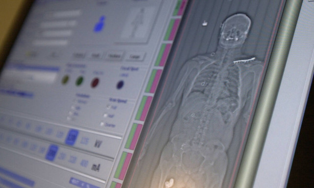 Κορονοϊός: Δείτε τι κάνει στο ανθρώπινο σώμα - Ποια όργανα επηρεάζει