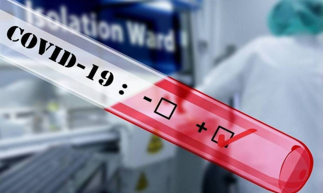 Δικηγόρος θετική στον κορονοϊό μιλά στο Newsbomb.gr: «Ένιωσα σαν να με τρώει ένα τέρας»