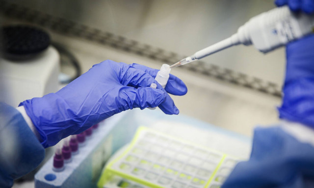 Κορονοϊός: Η Ελλάδα παρήγγειλε 5 τόνους χλωροκίνη - Ελπίδες για φάρμακο από την Ιαπωνία