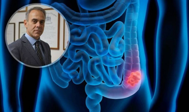 Καρκίνος παχέος εντέρου και ορθού και πρόληψη