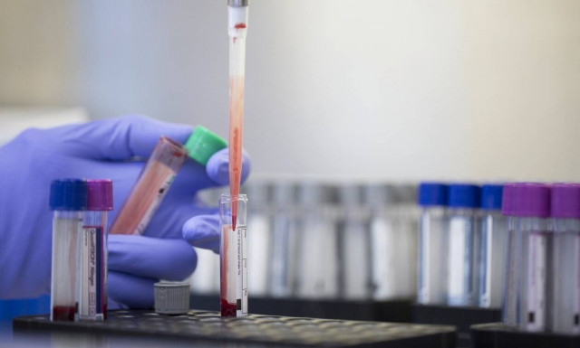 Κορονοϊός: Συχνές οι αιματολογικές επιπλοκές της λοίμωξης COVID-19