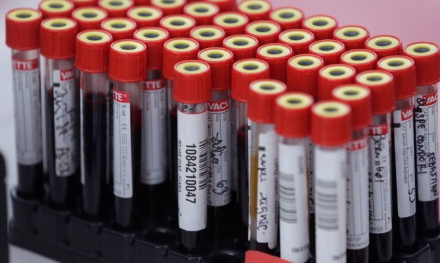 Κορονοϊός: Ελληνίδα γιατρός - Ίσως και το Σεπτέμβριο αποτελεσματικό εμβόλιο