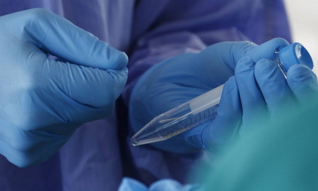 Κορονοϊός - Θεσσαλία: Νέοι έλεγχοι στο σύνολο των οικισμών Ρομά