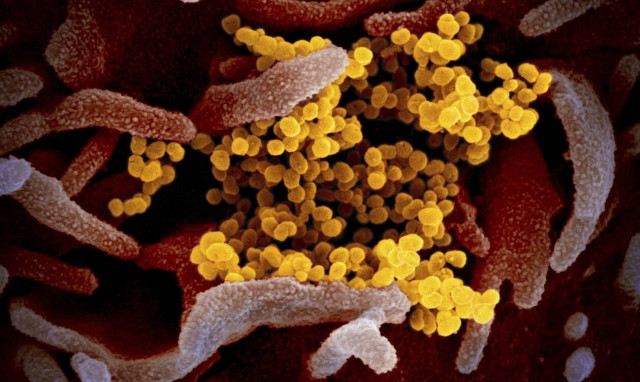 Ανοσία στον κορονοϊό: Πόσοι, ποιοι και για πόσο έχουν αποκτήσει ανοσία;