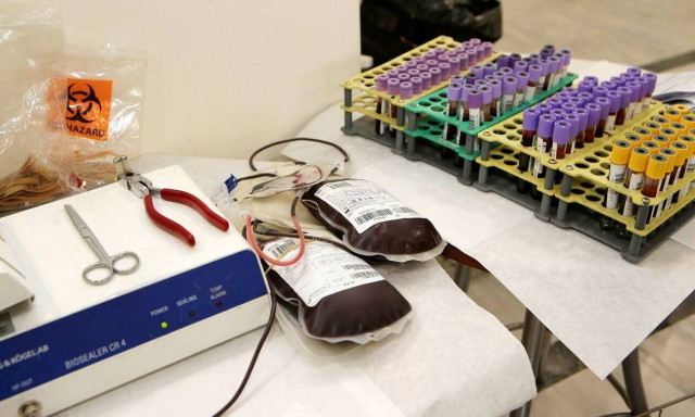 Κορονοϊός στην Ελλάδα: Ανάγκη για αίμα – Εθελοντική αιμοδοσία στο ΕΚΠΑ και στο Δήμο Αθηναίων 