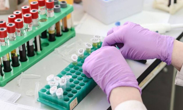 Κορονοϊός: Η φερριτίνη μπορεί να μας δείξει αν θα νοσήσουμε σοβαρά από τον ιό