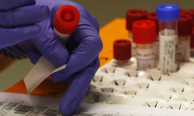 Κορονοϊός: Περισσότερες από 130 θεραπείες μελετώνται, σύμφωνα με τη φαρμακευτική βιομηχανία