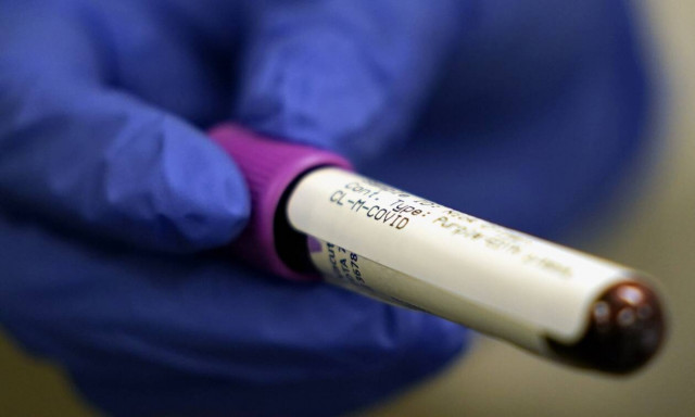 Κορονοϊός: Το νέο περιβάλλον για τη φαρμακοβιομηχανία στην Ευρώπη – Οι προτάσεις της EFPIA 